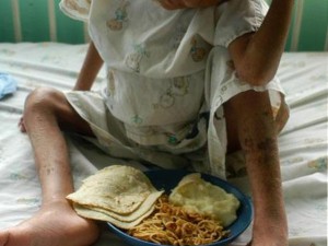 Lucha contra la desnutrición crónica infantil en el Acuerdo Nacional